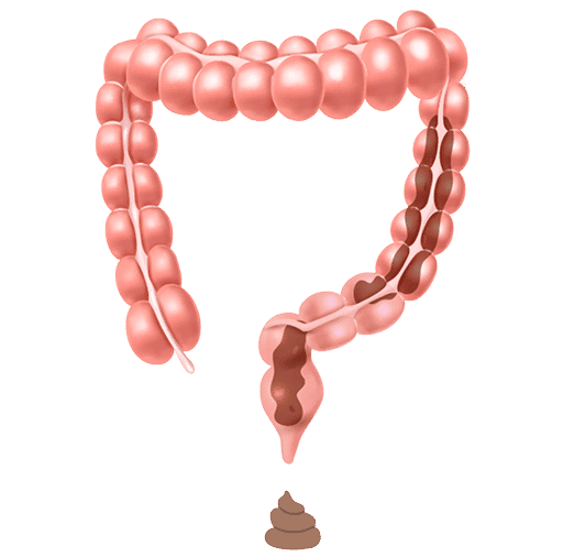 Diarrhoea Treatment