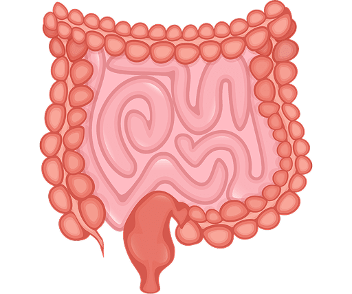 diverticular