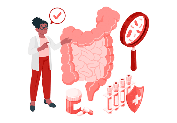 diverticulitis