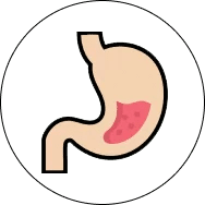 Persistent heartburn or acid reflux