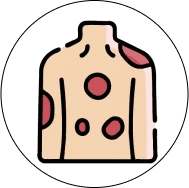 Patches of red, swollen skin