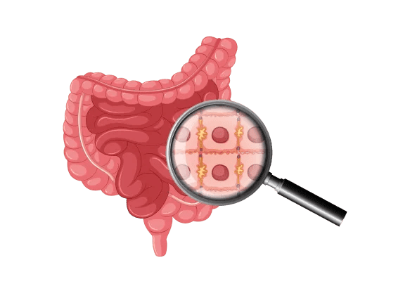Understanding Constipation