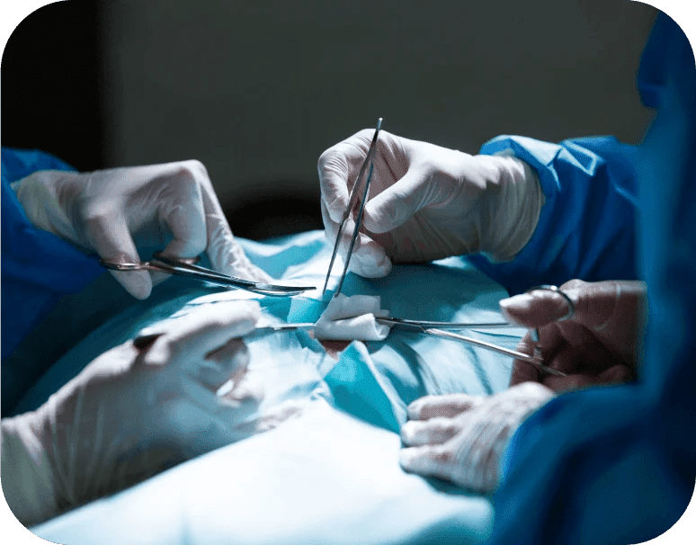 Surgical Interventions