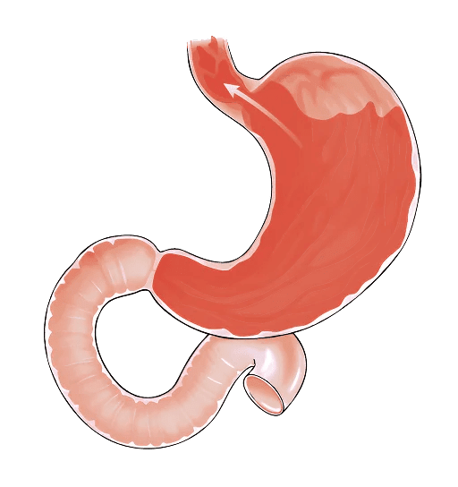 Functional Dyspepsia